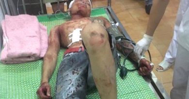 Nạn nhân Bùi Ngọc Anh và Nguyễn Đức Toàn bị thương nặng nhất